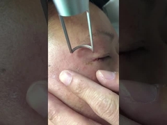 a máquina 1064nm 532nm Q do laser do picosegundo 450ps comutou Nd Yag