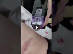 Máquina de Microneedle de RF fracionada de 50W 100V a 240V