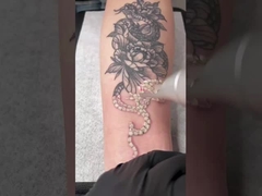 a máquina 1064nm 532nm Q do laser do picosegundo 450ps comutou Nd Yag